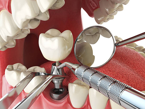 Best Emergency Dentist for Special Needs Patients in Ellettsville, IN